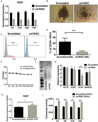 The Telomerase Complex Directly Controls Hematopoietic Stem Cell Differentiation and Senescence in an Induced Pluripotent Stem Cell Model of Telomeropathy